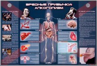 Электрифицированный стенд "Вредные привычки: алкоголизм" - fgospostavki.ru - Апатиты