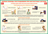 Таблица "Порядок действий при опасном кровотечении" (100х140 сантиметров, винил) - fgospostavki.ru - Апатиты