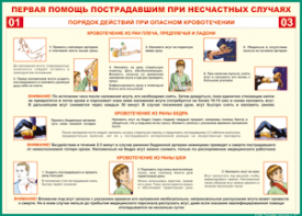 Таблица "Порядок действий при опасном кровотечении" (100х140 сантиметров, винил) - fgospostavki.ru - Апатиты